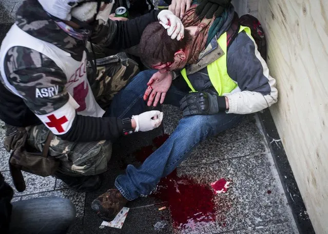 Medics tend to a “Yellow Vests” protester's head injury during demonstrations in Paris, France on December 15, 2018. (Photo by Elyxandro Cegarra/SIPA Press/Rex Features/Shutterstock)