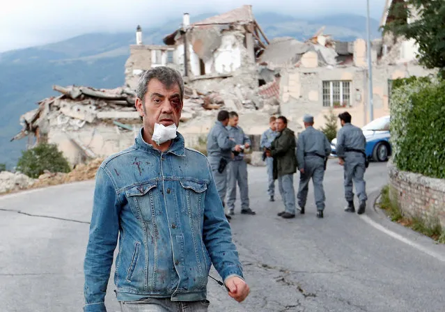 A wounded man walks along the road following an earthquake in Amatrice, central Italy, August 24, 2016. (Photo by Remo Casilli/Reuters)