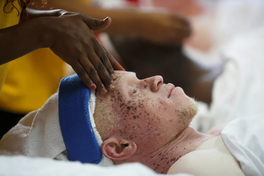 Mr. & Miss Albinism East Africa Contest in Nairobi