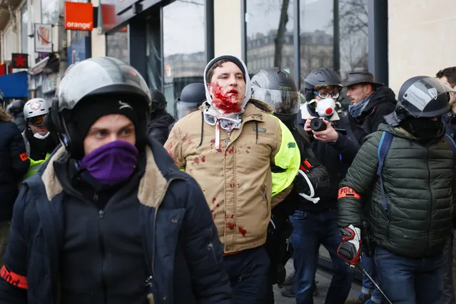 A bleeding demonstrator is taken away by police officers during a yellow vest protest, Saturday, February 2, 2019 in Paris. France's yellow vest protesters were back on the streets Saturday to keep pressure on French President Emmanuel Macron's government and denounce the large number of people injured in demonstrations they say is the result of police violence. (Photo by Francois Mori/AP Photo)