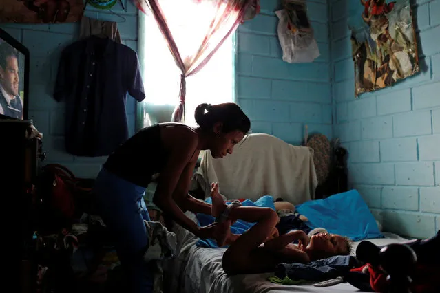 Alejandra Jordan, 30, dresses her son Josue, before her sterilization surgery, at her home in San Francisco de Yare, Venezuela July 11, 2016. (Photo by Carlos Garcia Rawlins/Reuters)
