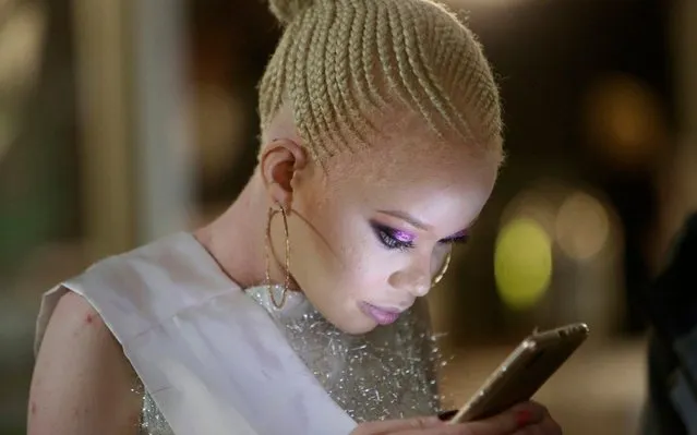 A contestant looks at her mobile phone during the Mr and Miss Zimbabwe Albinism pageant held in Harare, early Saturday, May 25, 2019. About 70,000 of Zimbabwe’s estimated 16 million people are born with albinism, according to government figures. They often stand out, making them a subject at times of discrimination, ridicule and dangerously misguided beliefs. The Mr. and Miss Albinism Zimbabwe competition, now in its second year, is a chance to push back. (Photo by Tsvangirayi Mukwazhi/AP Photo)