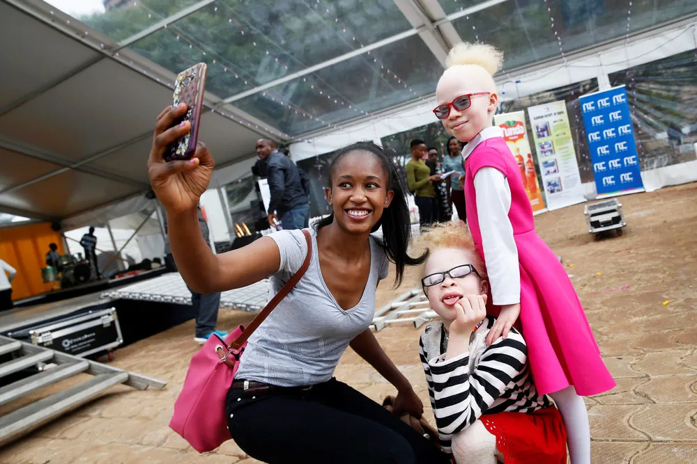 Mr. & Miss Albinism East Africa Contest in Nairobi