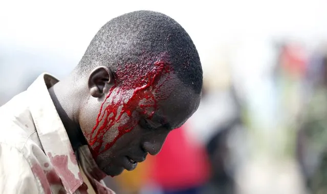 A protester bleeds after he was hit during clashes with riot police against the decision made by Burundi's ruling National Council for the Defence of Democracy-Forces for the Defence of Democracy (CNDD-FDD) party to allow President Pierre Nkurunziza to run for a third five-year term in office, in the capital Bujumbura, April 27, 2015. Burundi police fired tear gas and water cannon at protesters on Monday in the second day of demonstrations against Nkurunziza's bid for a third term in office, a Reuters witness said. (Photo by Thomas Mukoya/Reuters)