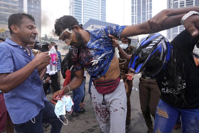 Anti-government protesters help a fellow protester who was beaten up by government supporters during a clash in Colombo, Sri Lanka, Monday, May 9, 2022. (Photo by Eranga Jayawardena/AP Photo)