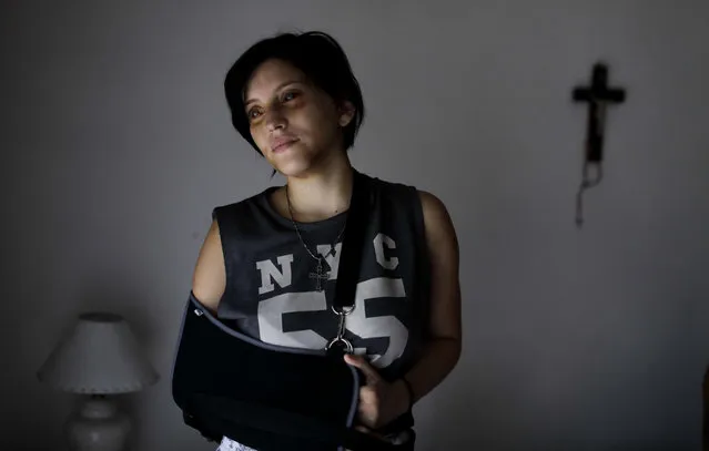 In this February 8, 2017 photo, Belen Torres poses for a portrait in Buenos Aires, Argentina. Torres was beaten by her boss, just a few days after starting her first job in the capital doing administrative paperwork for an anesthesiologist, to help her family pay the bills. The doctor asked her to get high and tried to have s*x with her. After he beat her, she was able to escape and run outside, where an unknown man called 911. (Photo by Natacha Pisarenko/AP Photo)
