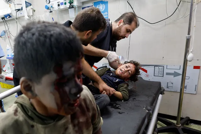 A Palestinian child, wounded in an Israeli strike, is assisted at Nasser hospital in Khan Younis in the southern Gaza Strip on November 13, 2023. (Photo by Mohammed Salem/Reuters)