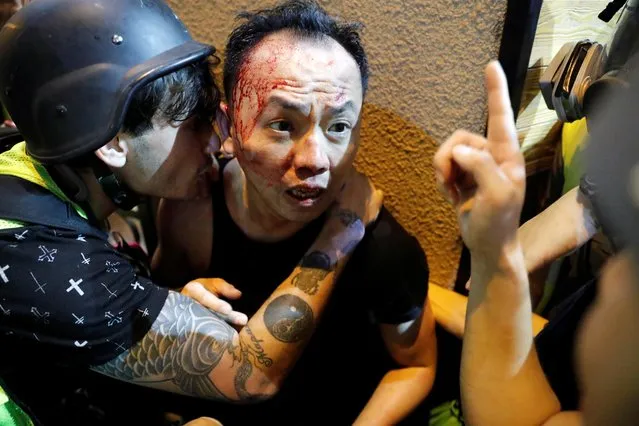 An injured man receives help from journalists after he was allegedly beaten by the anti-government protesters, in Hong Kong, China, September 29, 2019. (Photo by Tyrone Siu/Reuters)