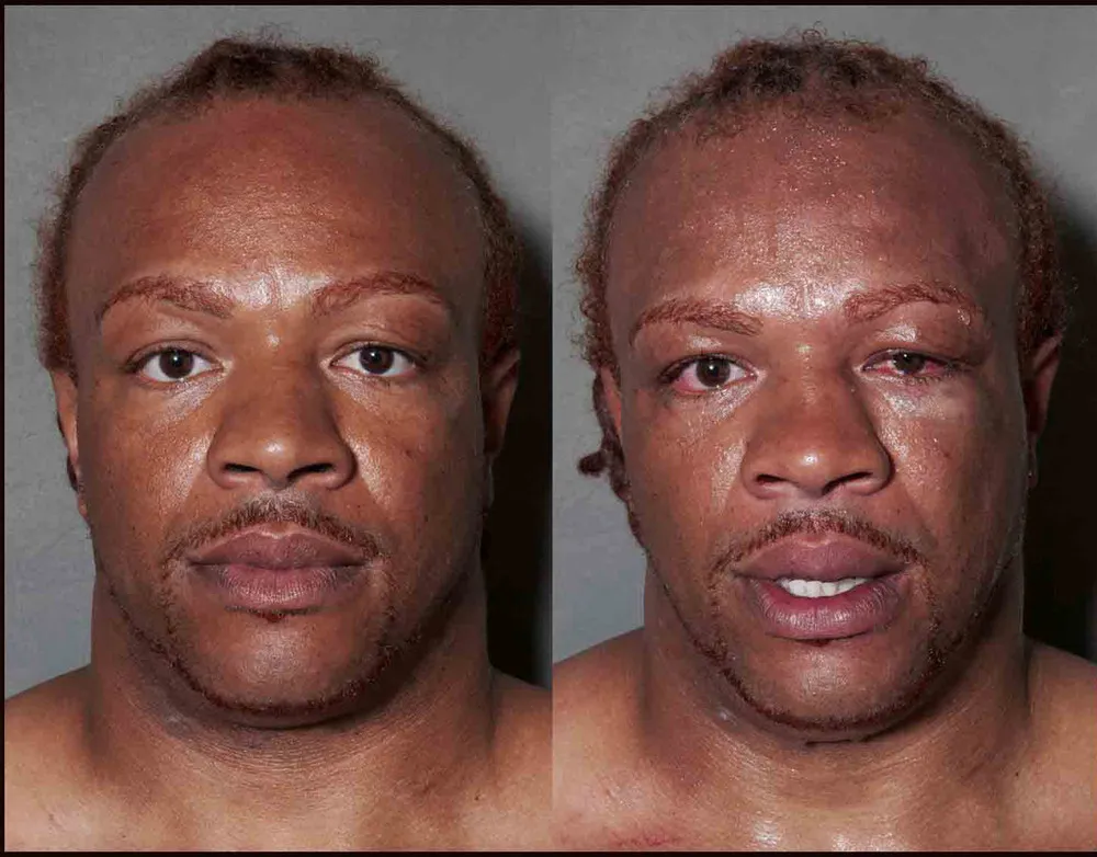 Boxing Before and After by Howard Schatz