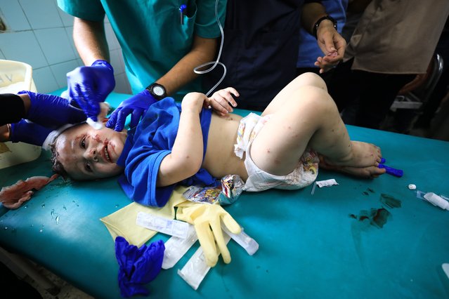 Doctors treat the wounded Palestinian children following the Israeli attack on Gold Market (Qissariya Market), at Al-Ahli Baptist Hospital in Gaza City, Gaza on July 4, 2024. (Photo by Dawoud Abo Alkas/Anadolu via Getty Images)