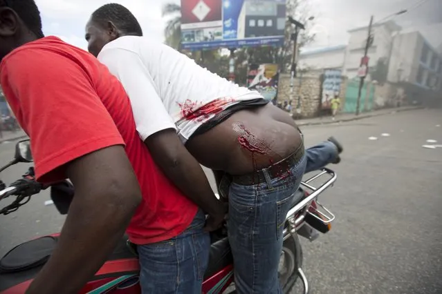A protester is taken to hospital after he was wounded by birdshot during a street protest after it was announced that the runoff Jan. 24, presidential election had been postponed, in Port-au-Prince, Haiti, Friday, January 22, 2016. (Photo by Dieu Nalio Chery/AP Photo)