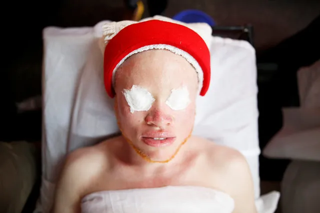 A participant receives a beauty treatment before the Mr & Miss Albinism Kenya Beauty Pageant 2018 in Nairobi, Kenya, November 30, 2018. (Photo by Baz Ratner/Reuters)