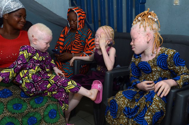 Albino children visit the headquarters of Albi International Association, as the albino community faces heightened risks as West Africa grapples with extreme heatwaves, in Cotonou, Benin on June 11, 2024. (Photo by Charles Placide Tossou/Reuters)