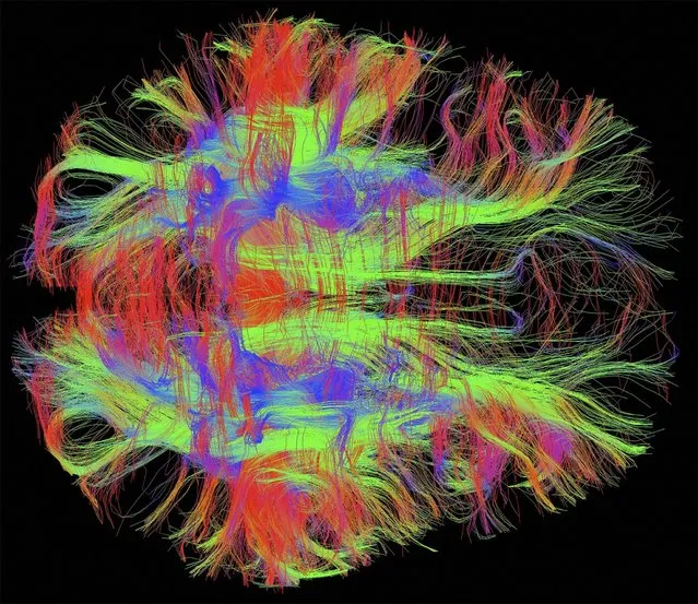 Bird's eye (axial) view of nerve fibres in a normal, healthy adult human brain. Brain cells communicate with each other through these nerve fibres, which have been visualised using diffusion weighted magnetic resonance imaging (DWI MRI). Diffusion weighted imaging is a specialised type of MRI scan which measures water diffusion in many directions in order to reconstruct the orientation of the nerve fibres. Since these images are in 3D, colours have been used to represent the direction of the fibres: blue is for fibres travelling up/down, green for front/back, and red for left/right. (Photo by Zeynep M. Saygin/McGovern Institute/MIT/Wellcome Images)