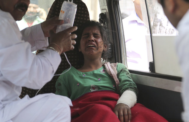 Nooren Akhtar, a 14-year-old Indian girl injured in cross border shelling between Indian and Pakistani soldiers in disputed Kashmir, arrives for treatment at the Government Medical College hospital in Jammu, India, Sunday, March 18, 2018. Five members of a family were killed after a shell fired by Pakistani soldiers hit their home in Poonch region of Indian-controlled Kashmir along the militarized Line of Control that divides the Himalayan territory between the two nuclear-armed rivals, said S.P. Vaid, the police chief. (Photo by Channi Anand/AP Photo)