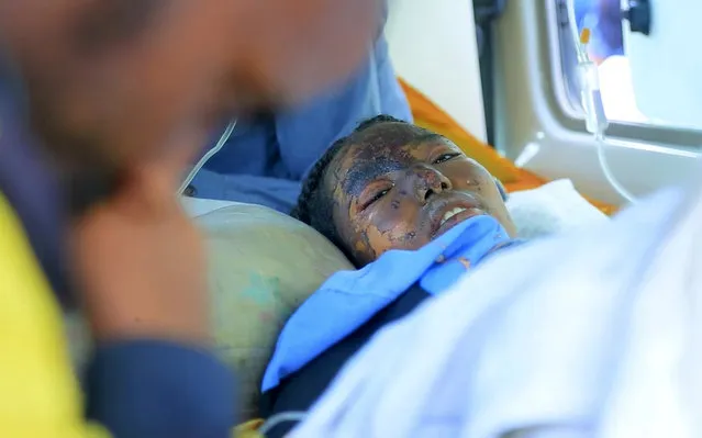In this image made from video, an injured victim of an alleged airstrike on a village arrives in an ambulance at the Ayder Referral Hospital in Mekele, in the Tigray region of northern Ethiopia, Wednesday, June 23, 2021. An airstrike hit a busy market in Ethiopia's northern Tigray village of Togoga on Tuesday and killed at least 51 people, according to health workers who said soldiers blocked medical teams from traveling to the scene. (Photo by AP Photo/Stringer)