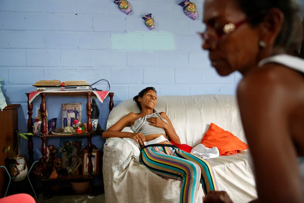In Crisis-hit Venezuela Young Women Seek Sterilization