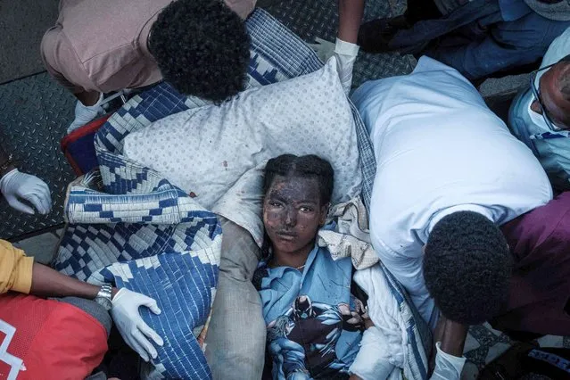 An injured resident of Togoga, a village about 20km west of Mekele, arrives on a stretcher to the Ayder referral hospital in Mekele, the capital of Tigray region, Ethiopia, on June 23, 2021, a day after a deadly airstrike on a market in Ethiopia's war-torn northern Tigray region, where a seven-month-old conflict surged again. Witnesses and medical personnel said dozens were killed or wounded at a busy market in Togoga town on June 22, 2021, as ballot counting was underway across much of the rest of the country following June 21's national election. (Photo by Yasuyoshi Chiba/AFP Photo)