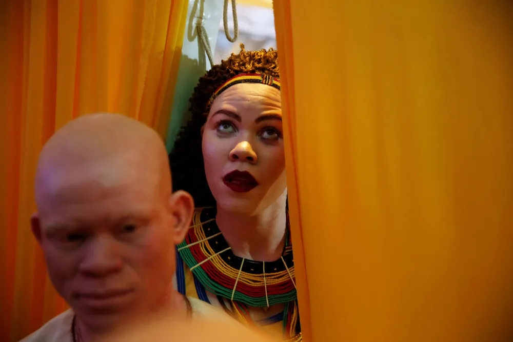Mr. & Miss Albinism East Africa Contest in Nairobi
