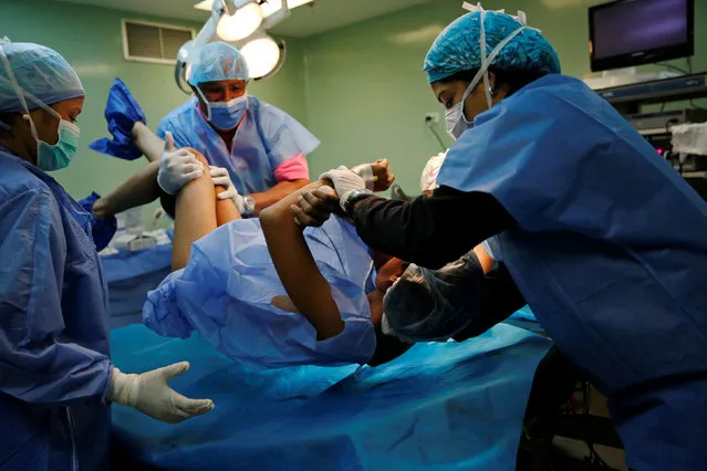 Medical personnel move a woman during her sterilization surgery in the operating room of a hospital in Caracas, Venezuela July 27, 2016. (Photo by Carlos Garcia Rawlins/Reuters)