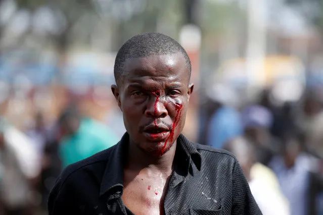An injured supporter of Kenyan opposition National Super Alliance (NASA) coalition walks after he clams he was stabbed during clashes in Nairobi, Kenya on November 17, 2017. (Photo by Baz Ratner/Reuters)
