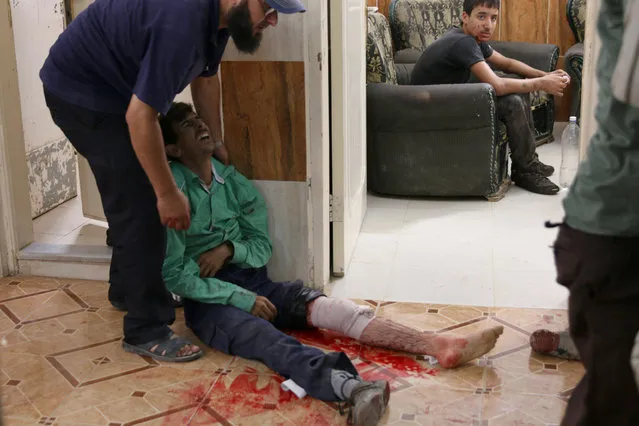 A man reacts to his wounds inside a field hospital after an airstrike in the rebel-held town of Dael, in Deraa Governorate, Syria September 18, 2016. (Photo by Alaa Al-Faqir/Reuters)