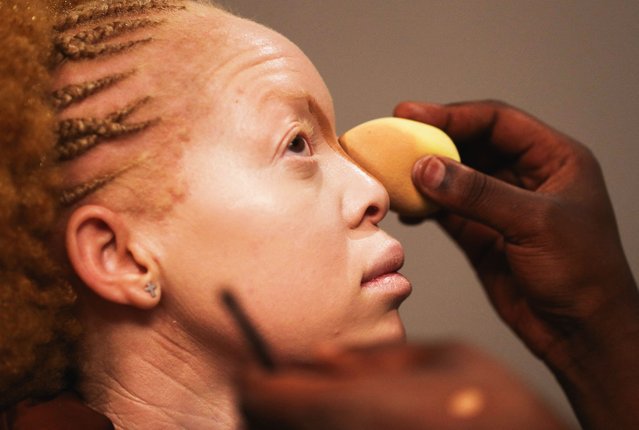 A female contestant has her make up done in preparation for the Mr and Miss Africa Albinism pageant at the Crown Plaza hotel in Harare, Zimbabwe, on June 28, 2025. (Photo by Philimon Bulawayo/Reuters)