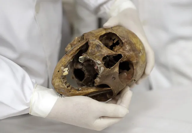 In this December 7, 2016 photo, forensic doctor Daniel Munoz shows the skull of Nazi war criminal Josef Mengele, at the school of medicine of Sao Paulo University in Sao Paulo, Brazil. In an ironic twist that many Holocaust survivors may see as a form of justice, forensic medical students in Brazil are now learning their trade with the remains of Josef Mengele, the notorious Nazi Angel of Death of the Auschwitz concentration camp who conducted horrific experiments on thousands of Jews. (Photo by Andre Penner/AP Photo)