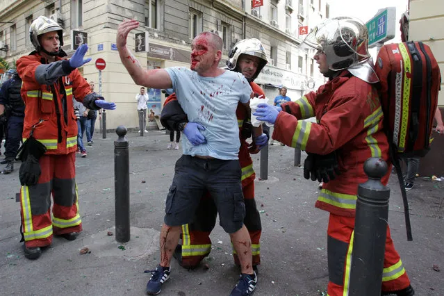 An English supporter injured after a street brawl is helped by a rescue squad ahead of the Euro 2016 football match England vs Russia, southern France, on June 11, 2016. (Photo by Jean Christophe Magnenet/AFP Photo)