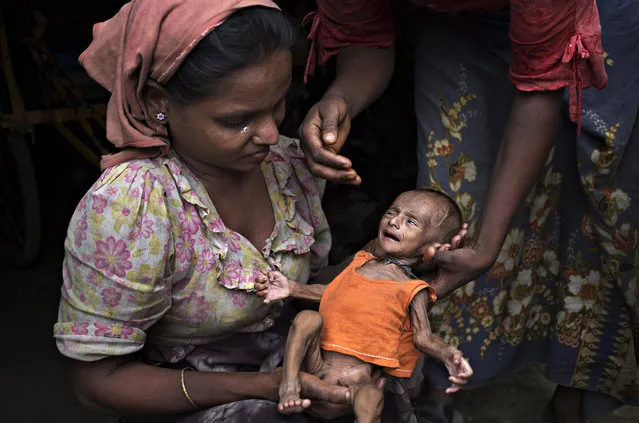 Rosheda, 20, holds her malnourished child, 2 months old, in front of her hut. She is too poor to afford enough food and the child will likely die without aid on May 6, 2014 in Sittwe, Burma. Some 150,000 Rohingya IDP (internally displaced people) are currently imprisoned in refugee camps outside of Sittwe in Rakhine State in Western Myanmar. (Photo by Andre Malerba/Getty Images)