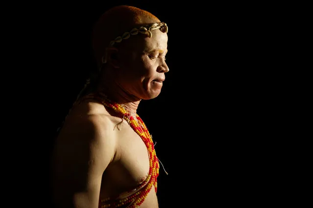 A participant waits back stage before getting on the catwalk during the Mr & Miss Albinism Kenya Beauty Pageant 2018 in Nairobi, Kenya, November 30, 2018. (Photo by Baz Ratner/Reuters)