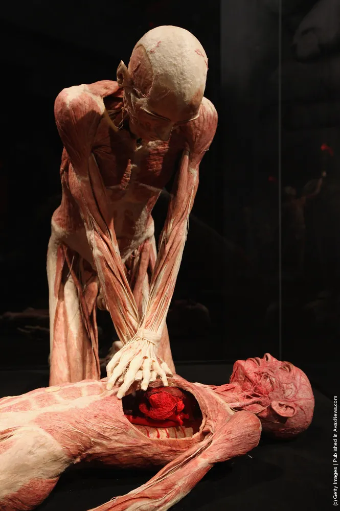 Body Worlds Exhibition To Open In Berlin