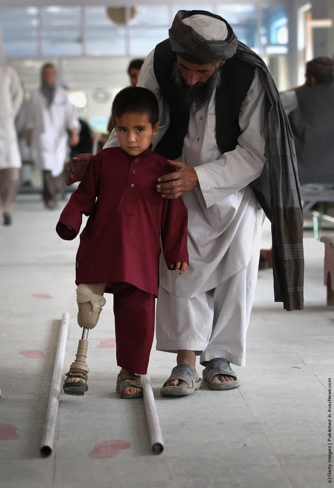 ICRC Orthopedic Center Treats Afghan War Amputees