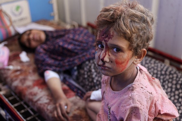 An injured child sits next to a woman at Al-Ahli Arab hospital, also known as the Baptist hospital in Gaza City following Israeli bombardment on the Hassan Salameh and Al-Nassr schools housing displaced Palestinians on August 4, 2024, amid the ongoing conflict between Israel and the militant Hamas group. Gaza's civil defence agency said an Israeli strike hit two schools in Gaza City on August 4, killing at least 30 people, while the Israeli army reported it had struck Hamas command centres. (Photo by Omar Al-Qattaa/AFP Photo)