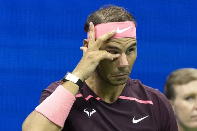 Spain's Rafael Nadal touches his bandage after receiving medical attention when he hit himself in the face with his racket during his 2022 US Open Tennis tournament men's singles second round match against Italy's Fabio Fognini at the USTA Billie Jean King National Tennis Center in New York, on September 1, 2022. (Photo by Corey Sipkin/AFP Photo)