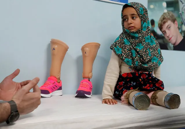 Maya Meri, 8, waits at a prosthetic center in Istanbul, Turkey, July 5, 2018. Picture taken July 5, 2018. (Photo by Osman Orsal/Reuters)