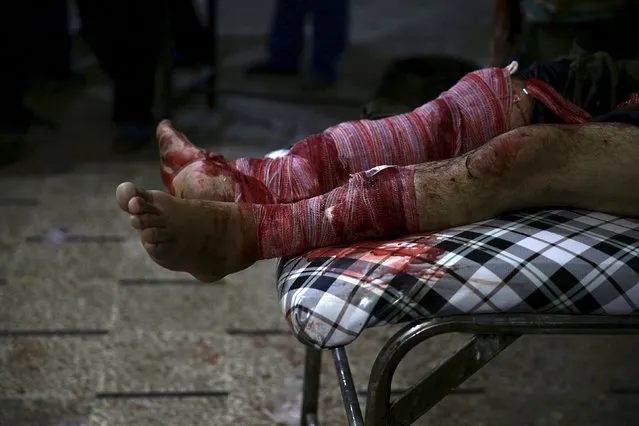 A man, injured in what activists said was an airstrike by forces loyal to Syria's president Bashar al-Assad, lies in a field hospital in the Douma neighborhood of Damascus, Syria December 6, 2015. (Photo by Bassam Khabieh/Reuters)