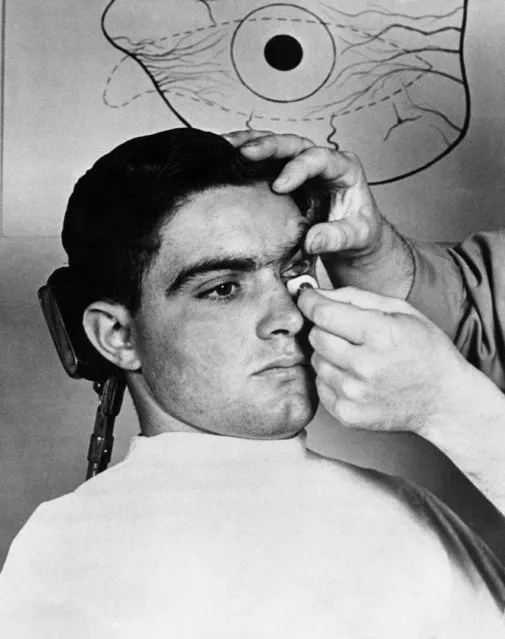 A man is fitted with an prosthetic eye, December 22, 1944. (Photo by AP Photo)