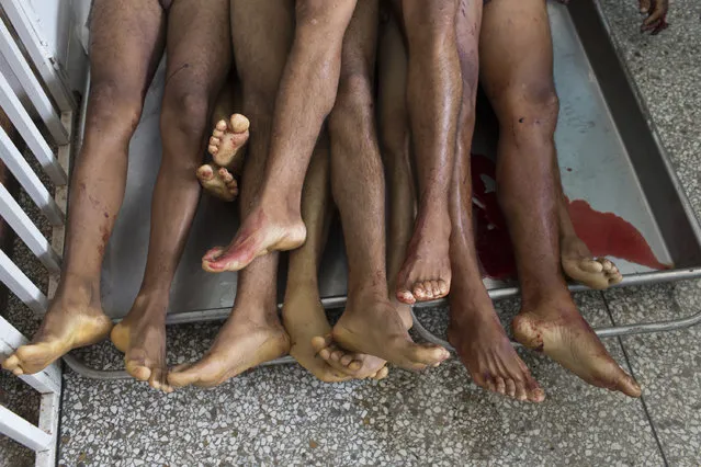 In this November 12, 2016 photo, the corpses of seven of nine men who were shot in the head while on their knees lie at the morgue in Cariaco, Sucre state, Venezuela. Five law enforcement officers were charged with storming the village and killing these men from a fishing family who were widely thought to have belonged to a gang. (Photo by Rodrigo Abd/AP Photo)