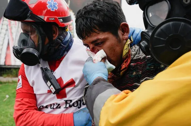 An injured demonstrator receives medical attention during an anti-government protest amid a stalemate between the government of President Guillermo Lasso and largely indigenous demonstrators who demand an end to emergency measures, in Quito, Ecuador on June 23, 2022. (Photo by Santiago Arcos/Reuters)