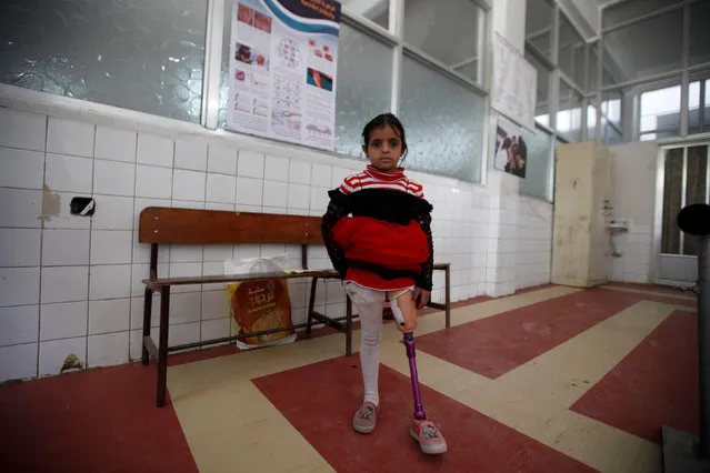 Batool al-Sayyadi, 7, who lost her leg by a Saudi-led air strike more than a year ago, stands at a prosthetic limbs centre in Sanaa, Yemen December 24, 2016. (Photo by Khaled Abdullah/Reuters)