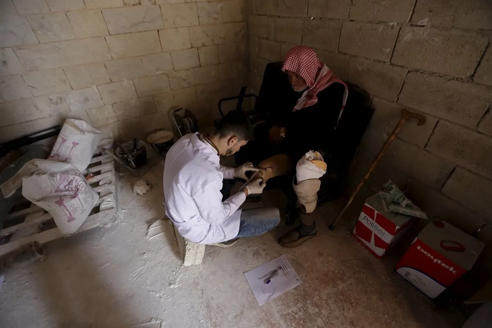 Syria's Mobile Amputee Clinic