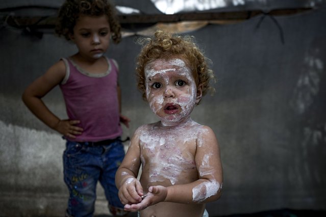 Displaced child Sham al-Hessi, center, who suffers from skin disease, is covered with skin cream as she poses for a picture, at a makeshift tent camp in Deir al-Balah, central Gaza Strip, Monday, July 29, 2024. Skin diseases are running rampant in Gaza, health officials say, from appalling conditions in overcrowded tent camps housing hundreds of thousands of Palestinians driven from their homes. (Photo by Abdel Kareem Hana/AP Photo)