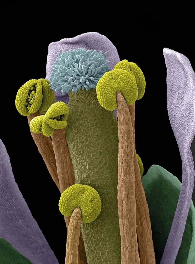 Wellcome Image Awards 2014 Shortlist: Life in Extreme Close-up