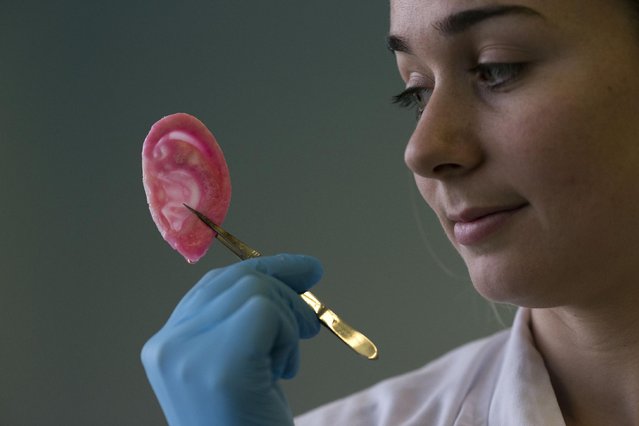 Dr Michelle Griffin, a plastic research fellow, poses for photographs with a synthetic polymer ear at her research facility in the Royal Free Hospital in London, Monday, March 31, 2014. (Photo by Matt Dunham/AP Photo)