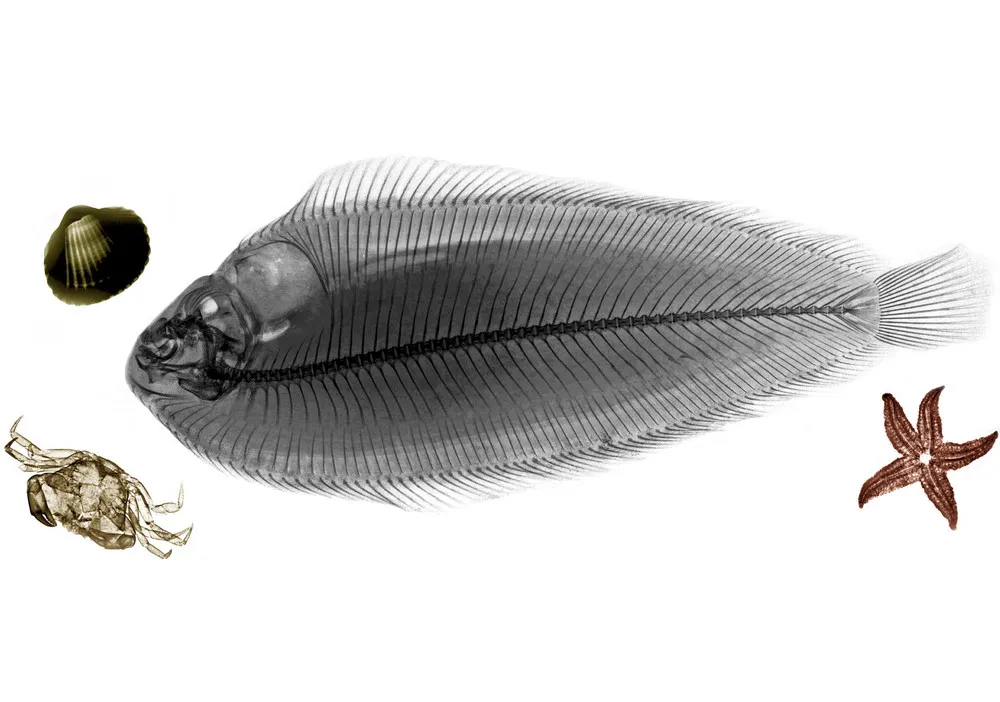 Colorized X-ray Photographs, Part 2