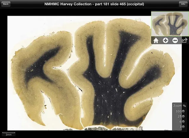 This digitized image, made on September 24, 2012 from a screen shot of a new iPad app by the National Museum of Health and Medicine Chicago, shows an image of brain tissue from renowned theoretical physicist Albert Einstein. The new application will allow users to see Einstein's brain as if they were looking through a microscope. (Photo by The National Museum of Health and Medicine Chicago)