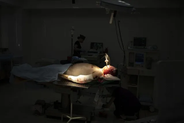 A Ukrainian soldier lays on the operating table before surgery after being injured as the Russian attack continues in Kharkiv, Ukraine, Friday, March 25, 2022. (Photo by Felipe Dana/AP Photo)