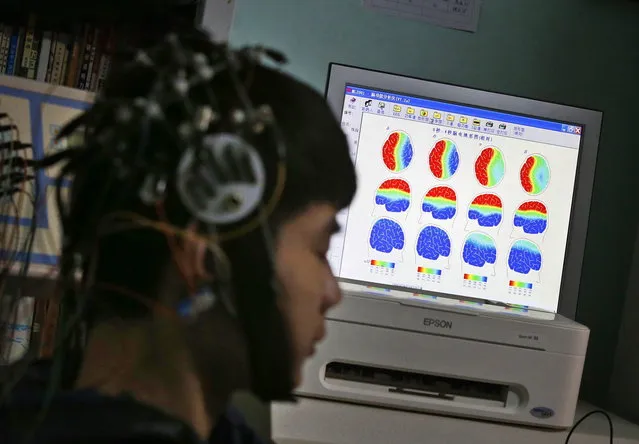 A boy who was addicted to the internet, has his brain scanned for research purposes at Daxing Internet Addiction Treatment Center in Beijing February 22, 2014. As growing numbers of young people in China immerse themselves in the cyber world, spending hours playing games online, worried parents are increasingly turning to boot camps to crush addiction. (Photo by Kim Kyung-Hoon/Reuters)