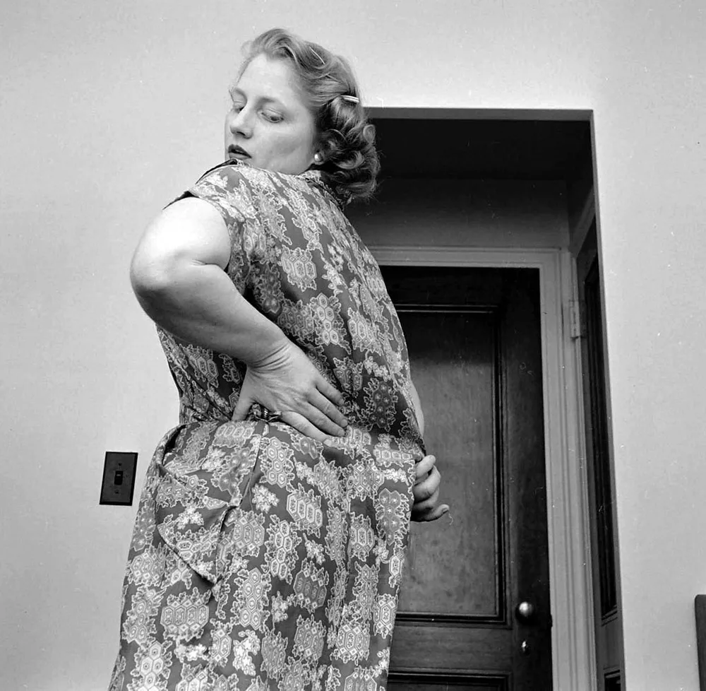 Obesity in 1950s America